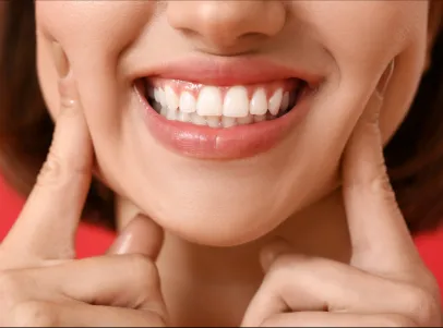 Gingivectomía